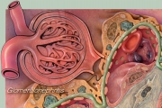 Glomerulonephritis